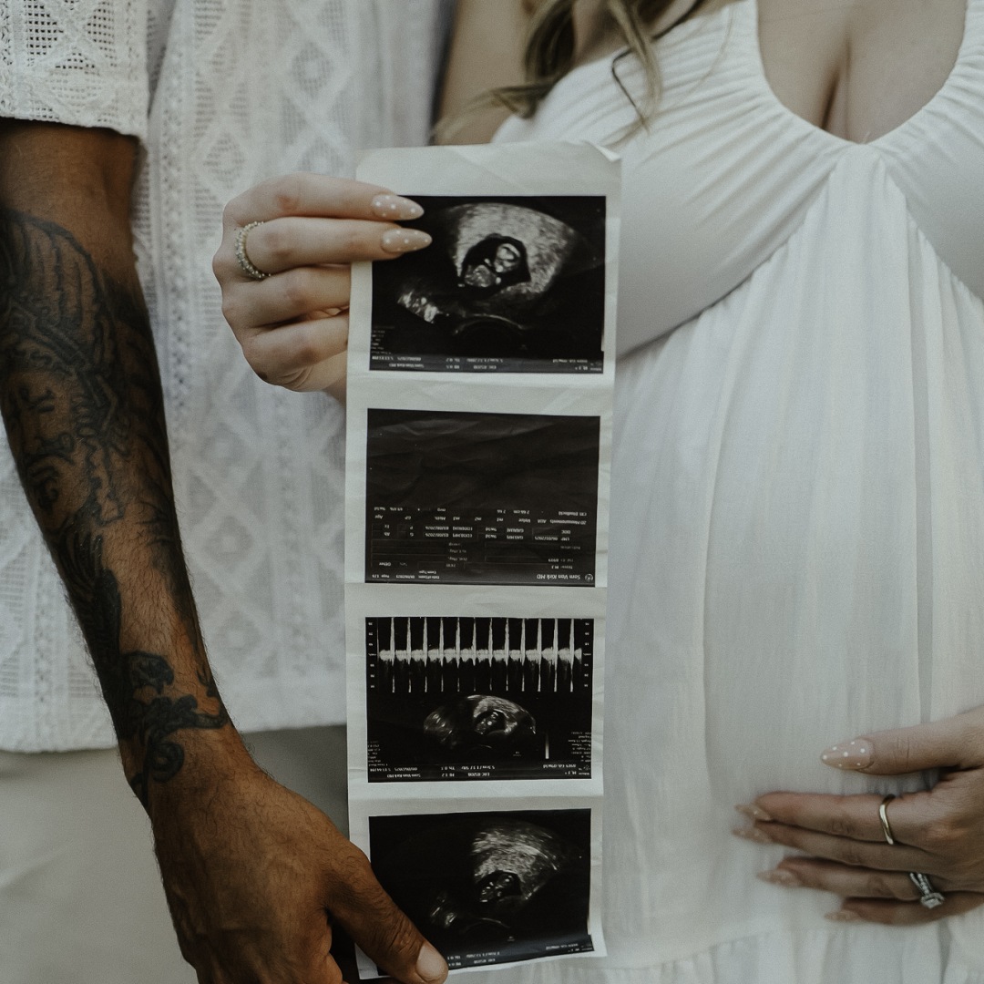 Photo shared by Jade for their Babylist baby registry.