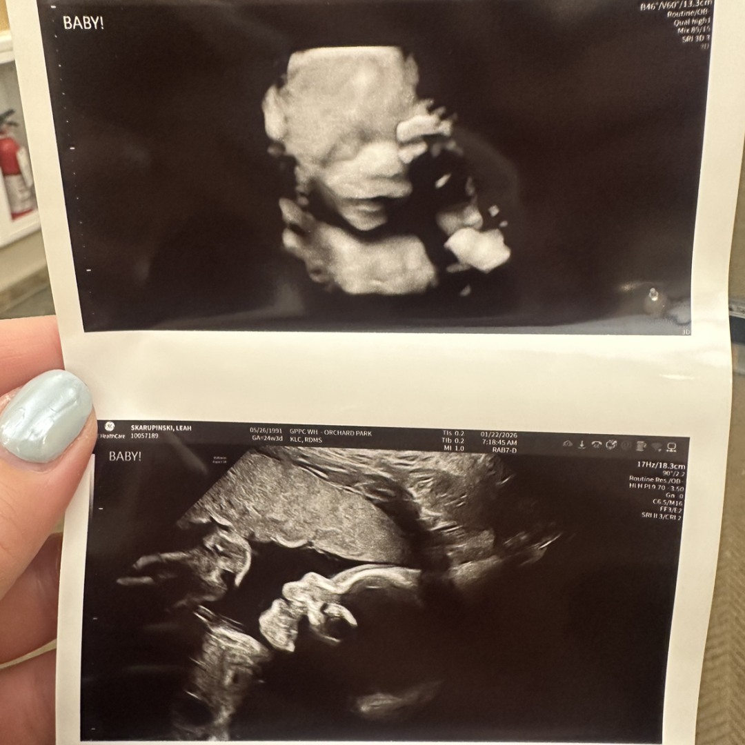 Photo shared by Leah for their Babylist baby registry.