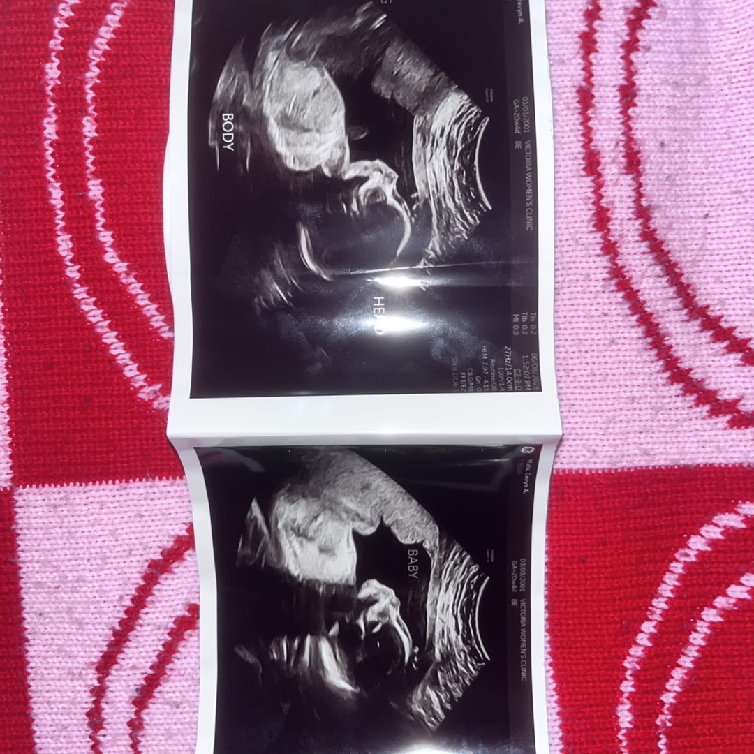 Photo shared by Devyn for their Babylist baby registry.