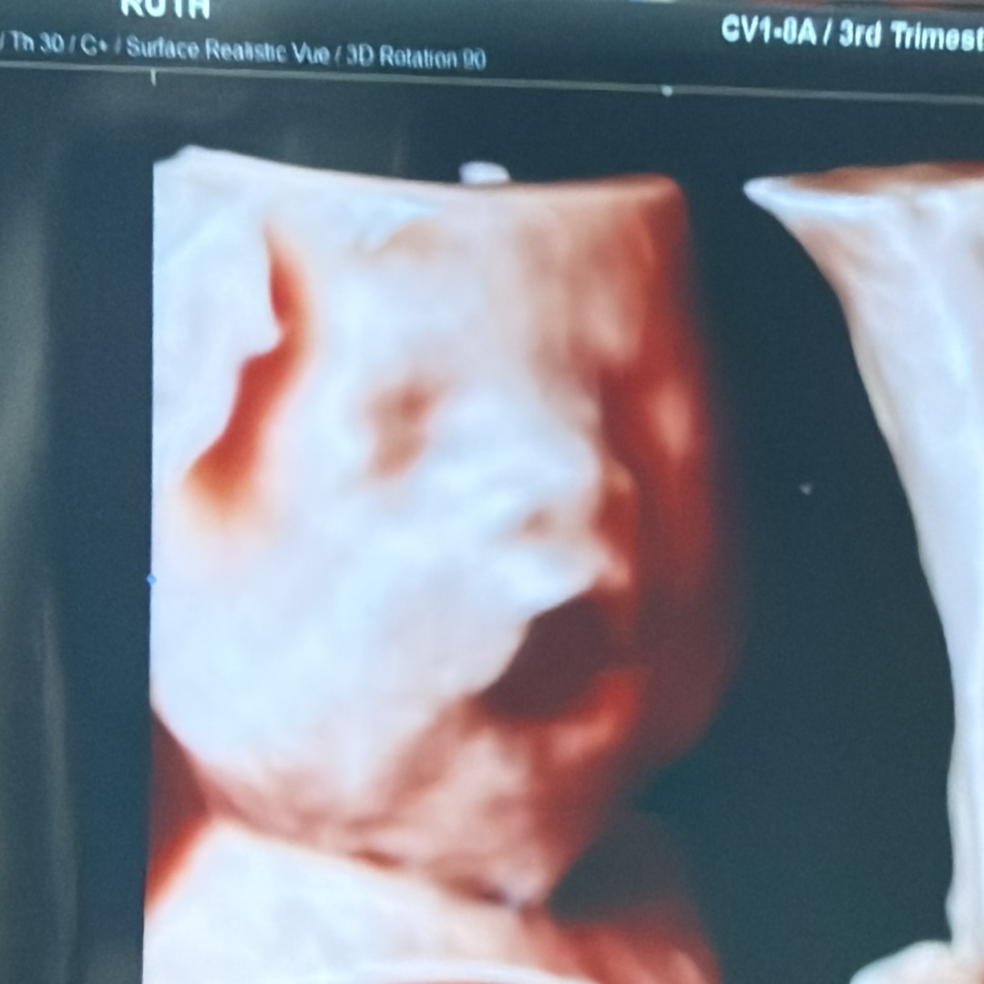 Photo shared by Ruth for their Babylist baby registry.
