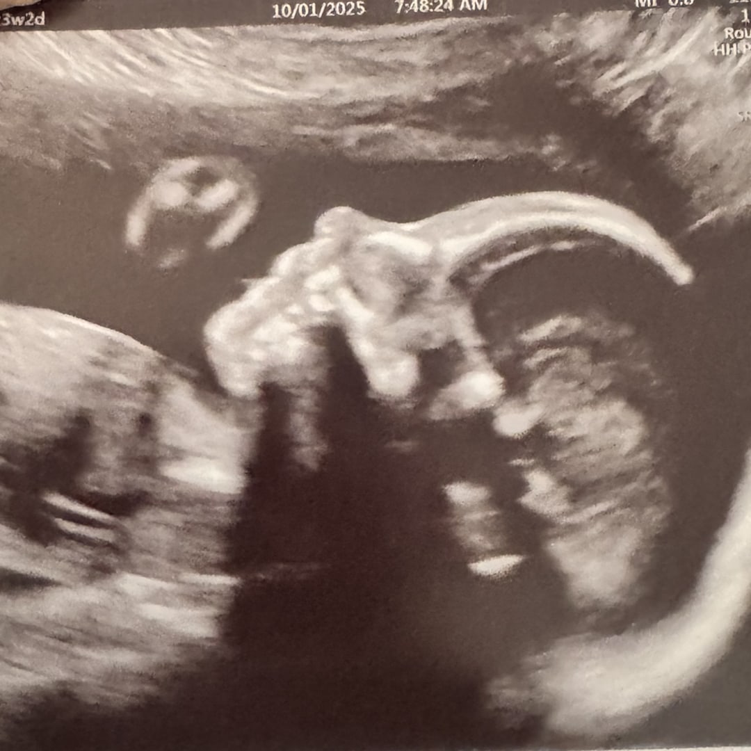 Photo shared by Jillian for their Babylist baby registry.