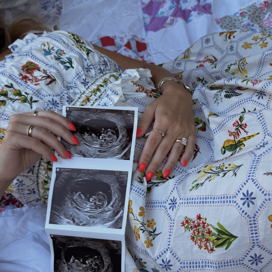 Photo shared by Madison for their Babylist baby registry.