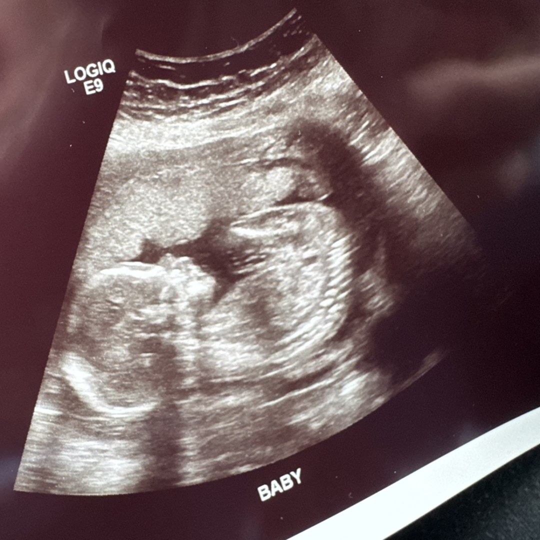 Photo shared by Brianne for their Babylist baby registry.