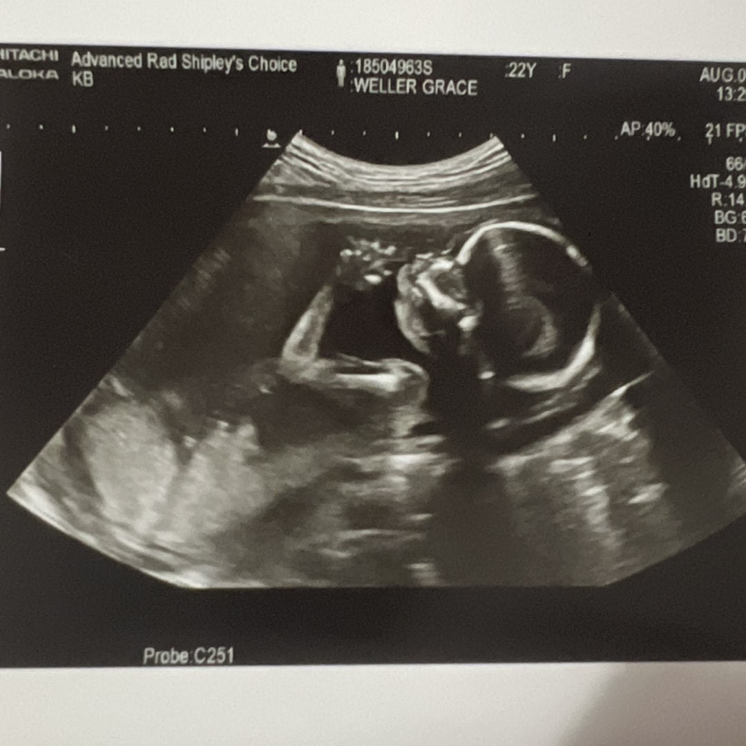 Photo shared by Grace for their Babylist baby registry.