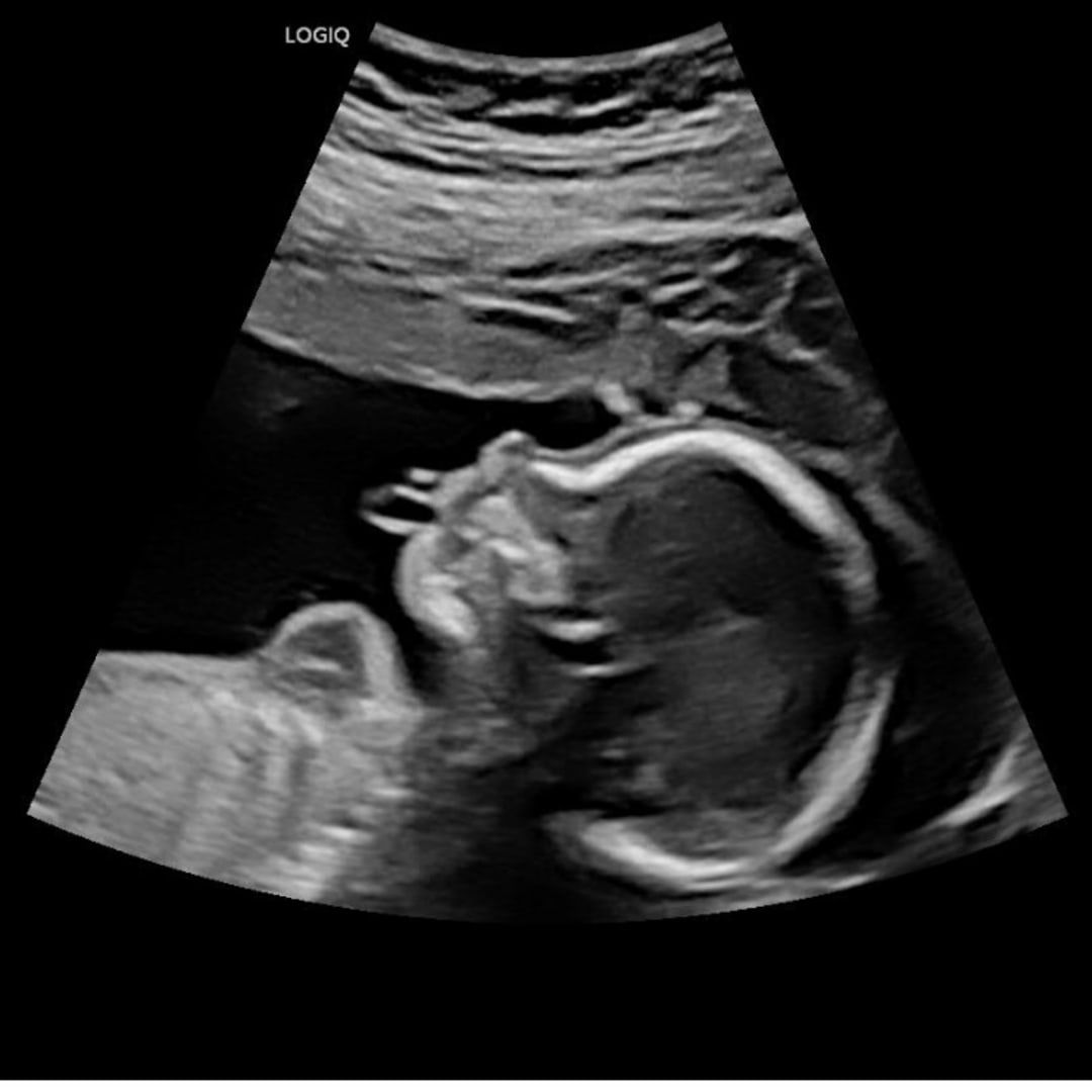 Photo shared by Makayla for their Babylist baby registry.