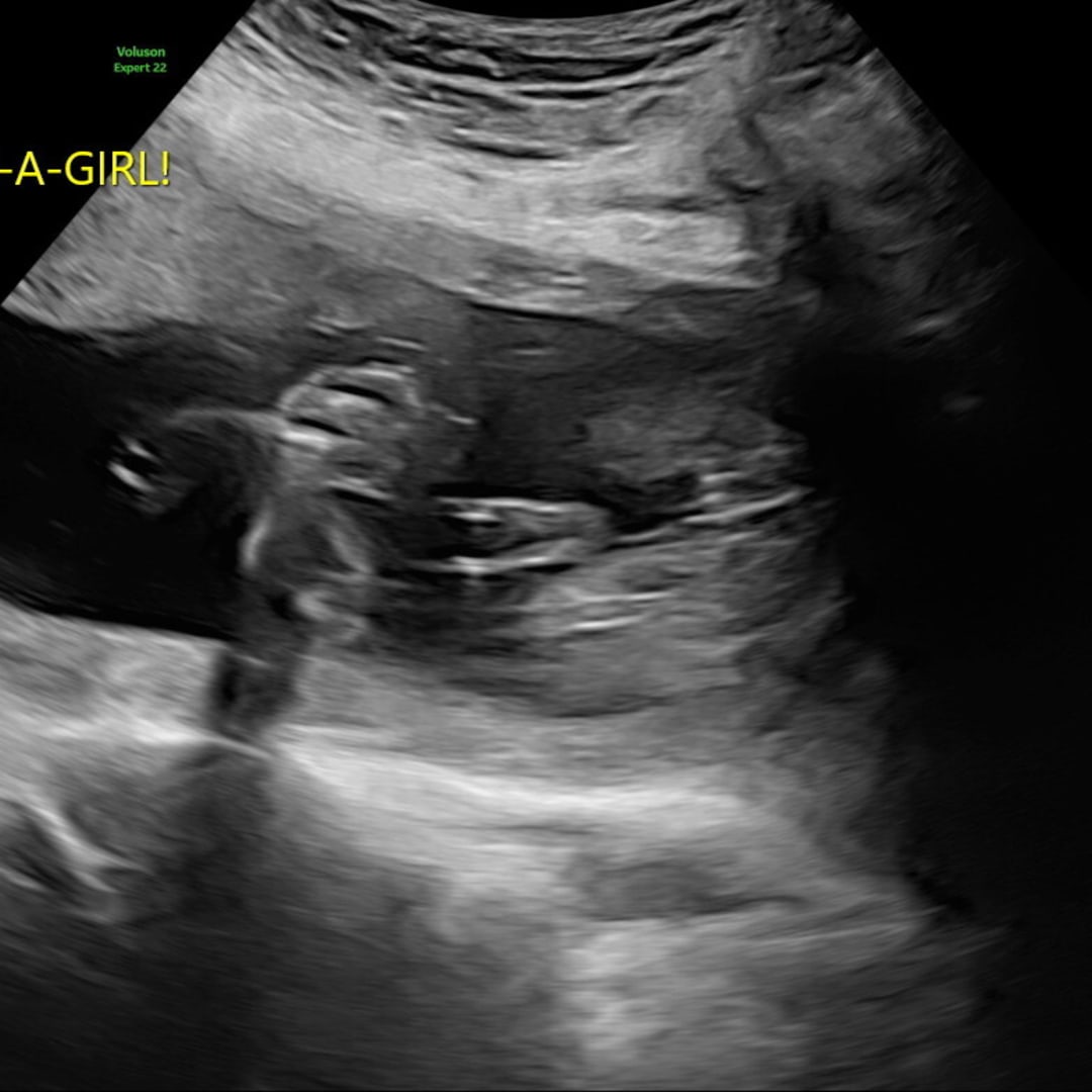 Photo shared by Samantha for their Babylist baby registry.