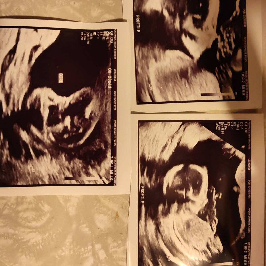 Photo shared by Katlin for their Babylist baby registry.
