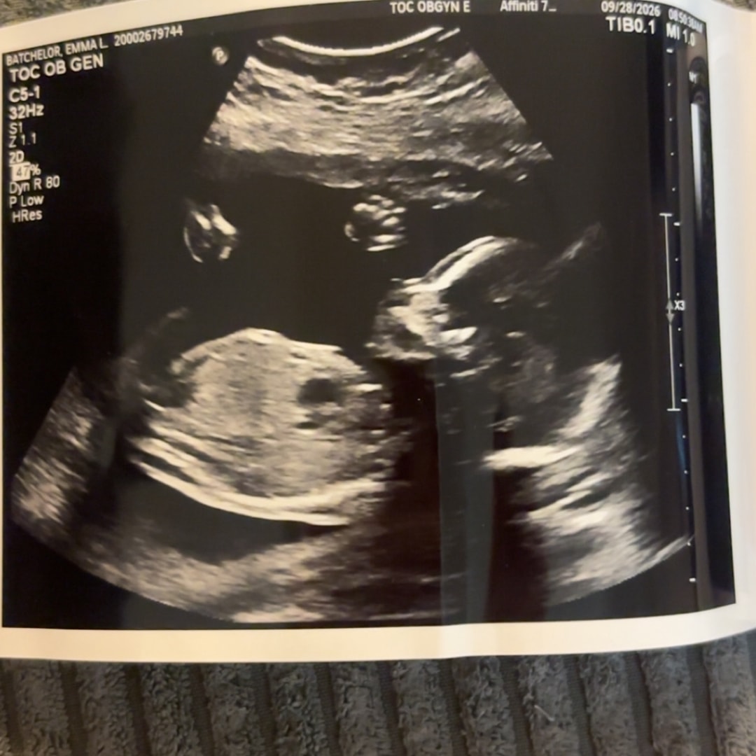 Photo shared by Emma for their Babylist baby registry.