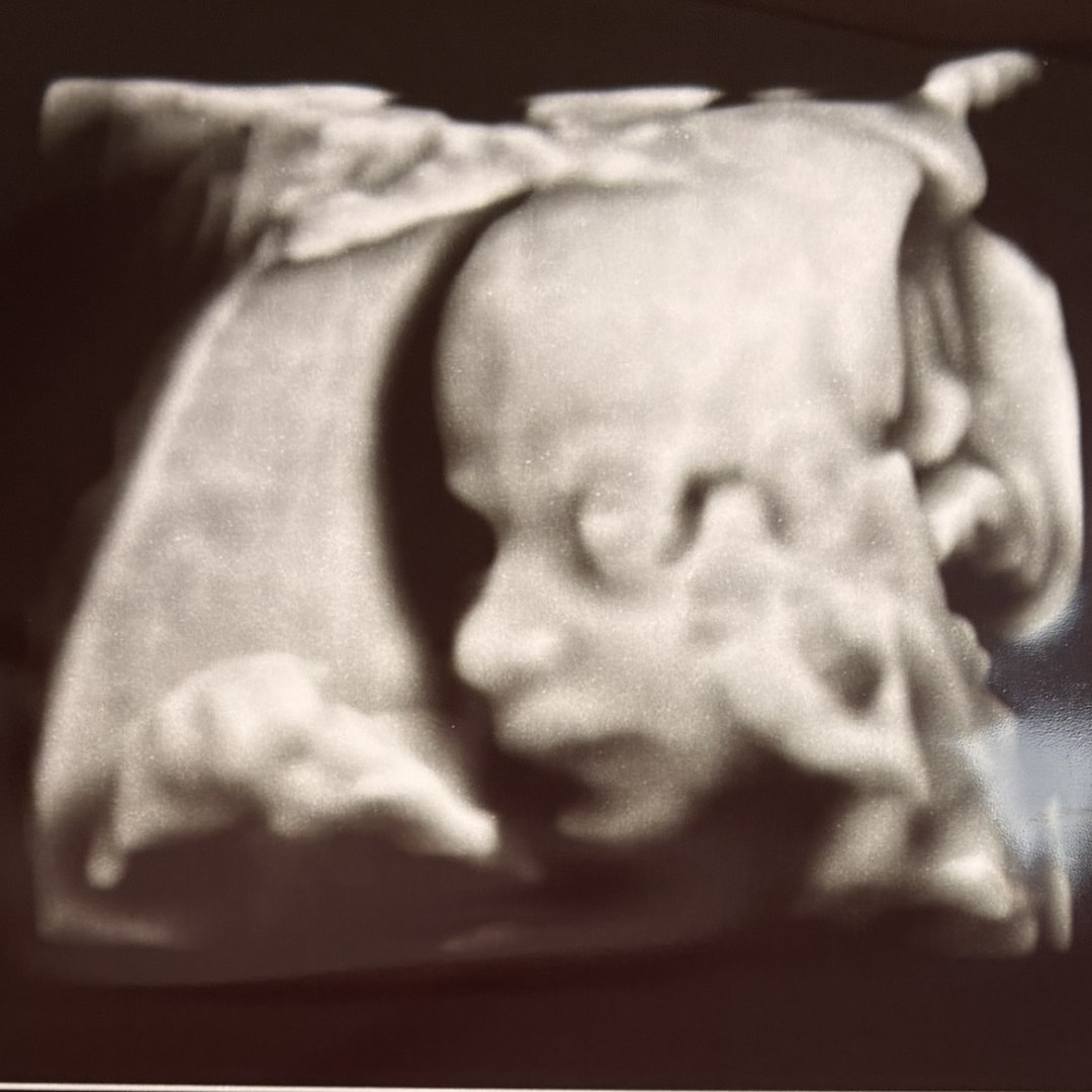 Photo shared by Camryn for their Babylist baby registry.