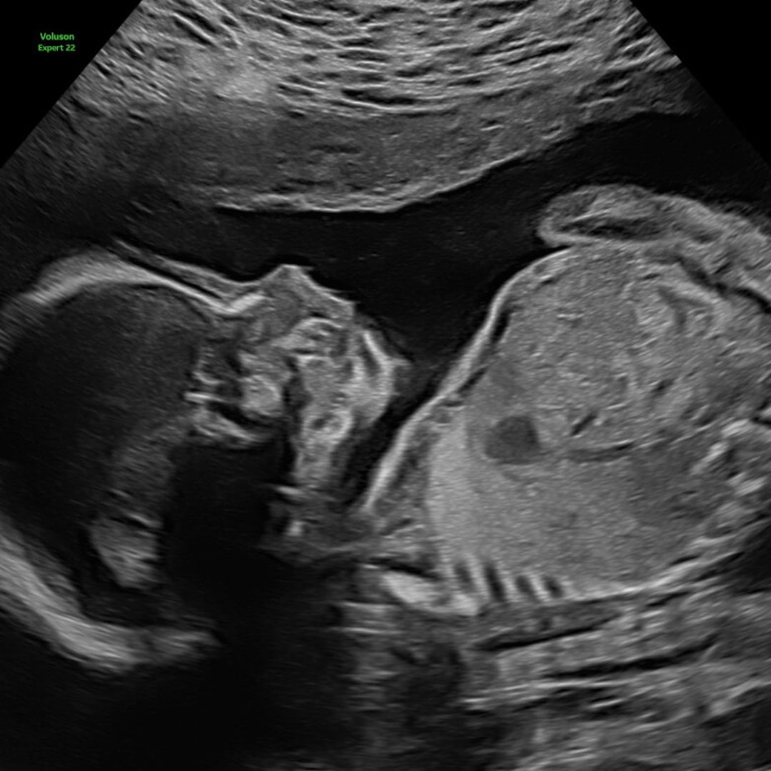 Photo shared by Jenna for their Babylist baby registry.