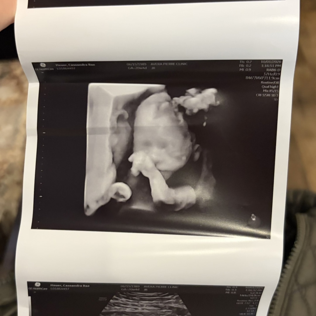 Photo shared by Cassi for their Babylist baby registry.