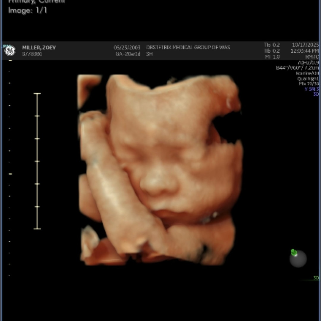 Photo shared by Zoey for their Babylist baby registry.