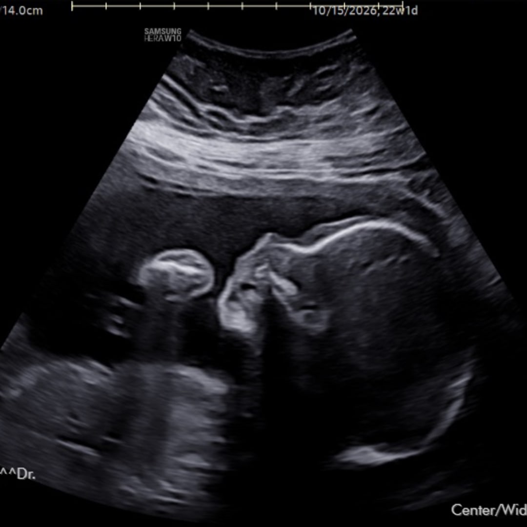 Photo shared by Jaime for their Babylist baby registry.