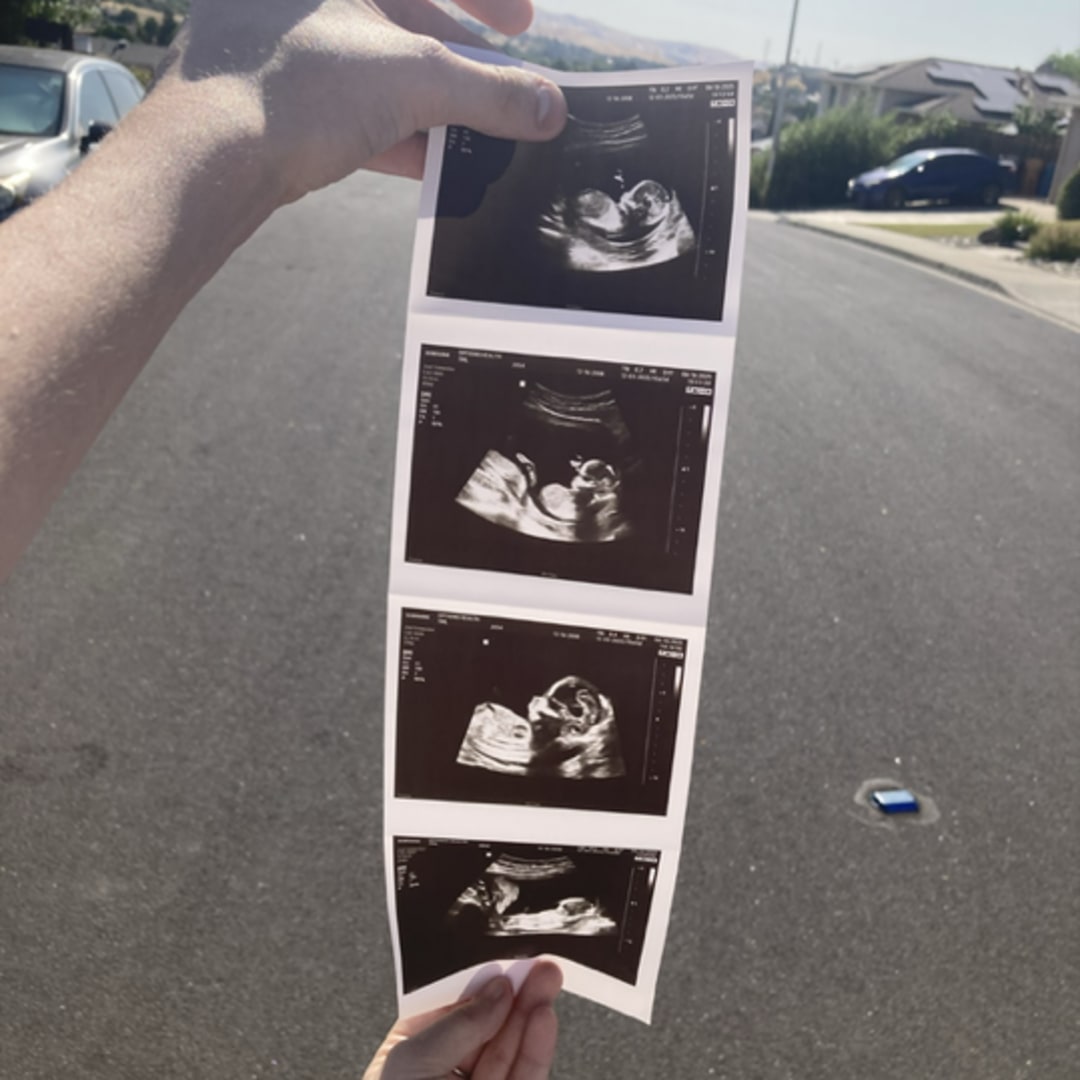 Photo shared by Cassandra for their Babylist baby registry.