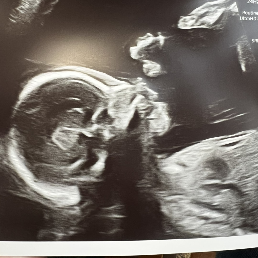 Photo shared by Anna for their Babylist baby registry.