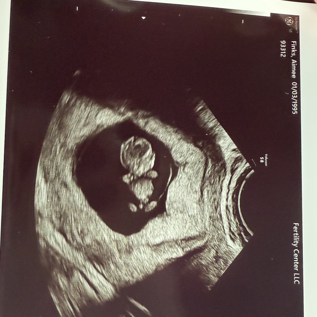 Photo shared by Aimee for their Babylist baby registry.