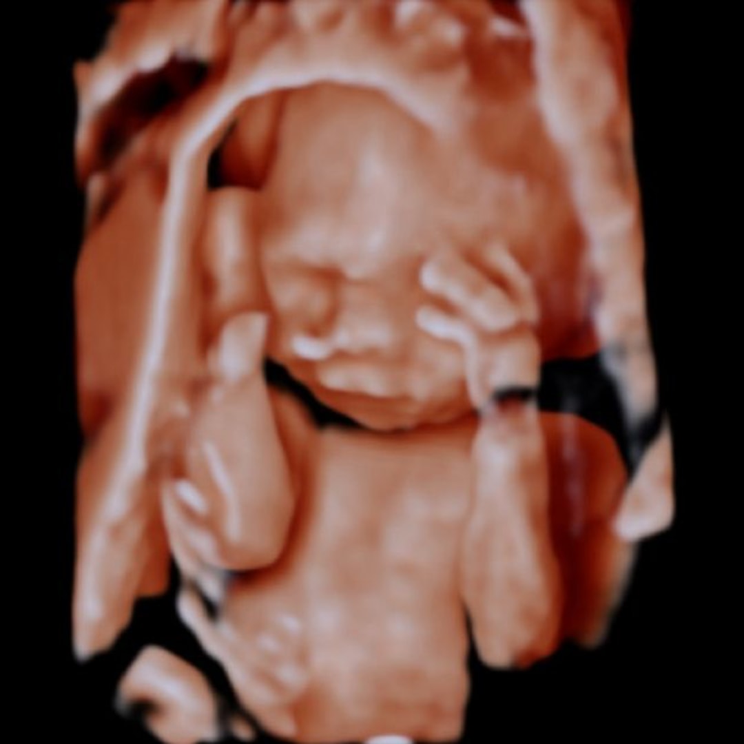 Photo shared by Jaiane for their Babylist baby registry.