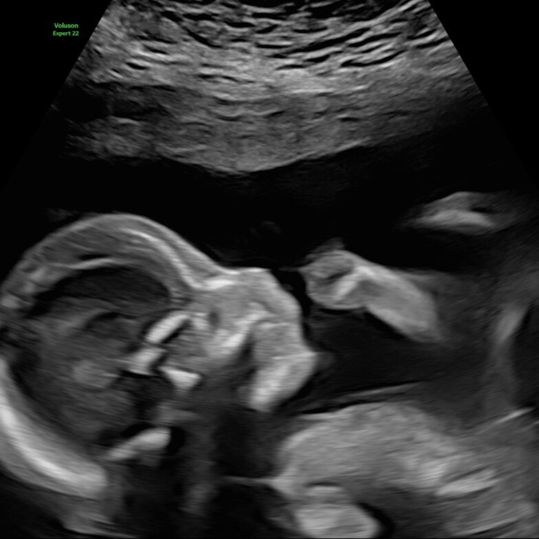 Photo shared by Keanah for their Babylist baby registry.