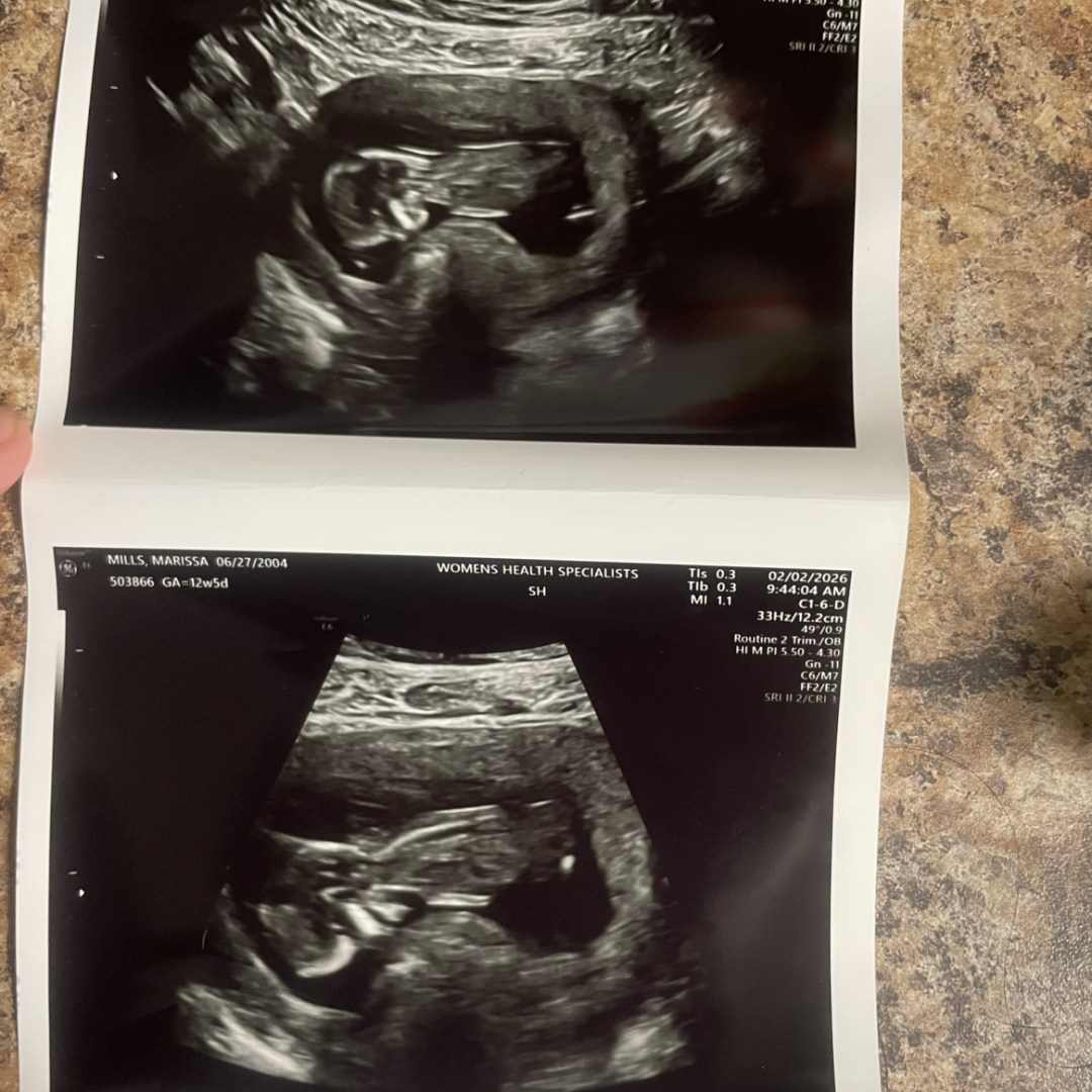 Photo shared by Marissa for their Babylist baby registry.