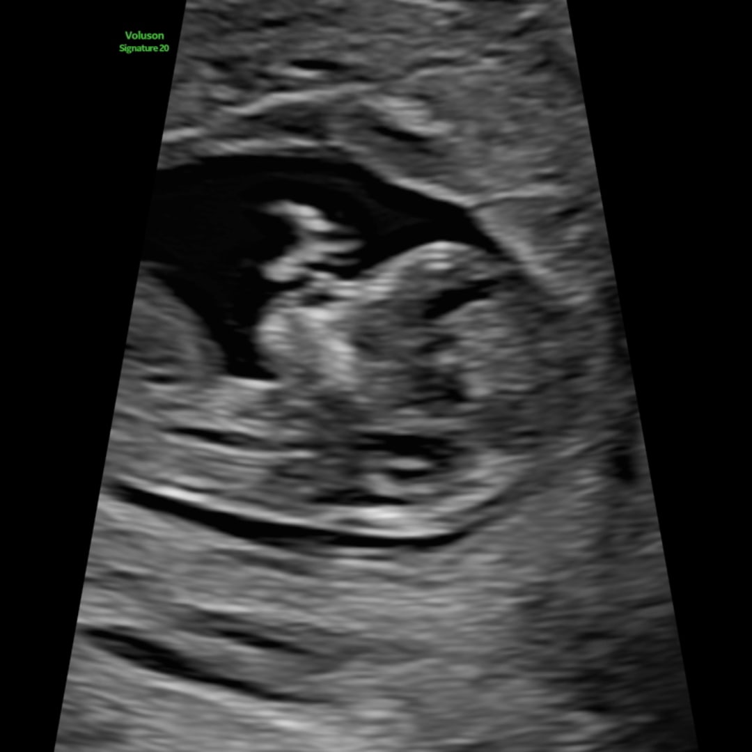 Photo shared by Hayley for their Babylist baby registry.