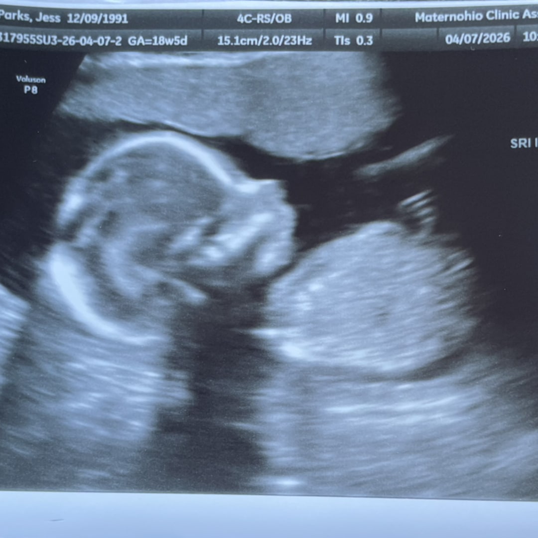 Photo shared by Jess for their Babylist baby registry.