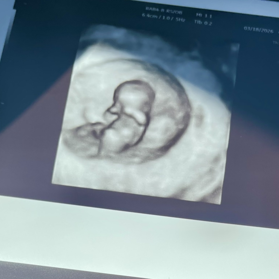 Photo shared by Kaitlyn for their Babylist baby registry.