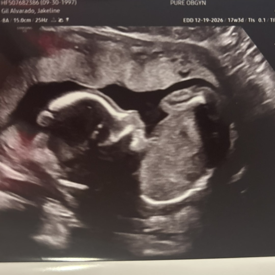 Photo shared by Jackky for their Babylist baby registry.