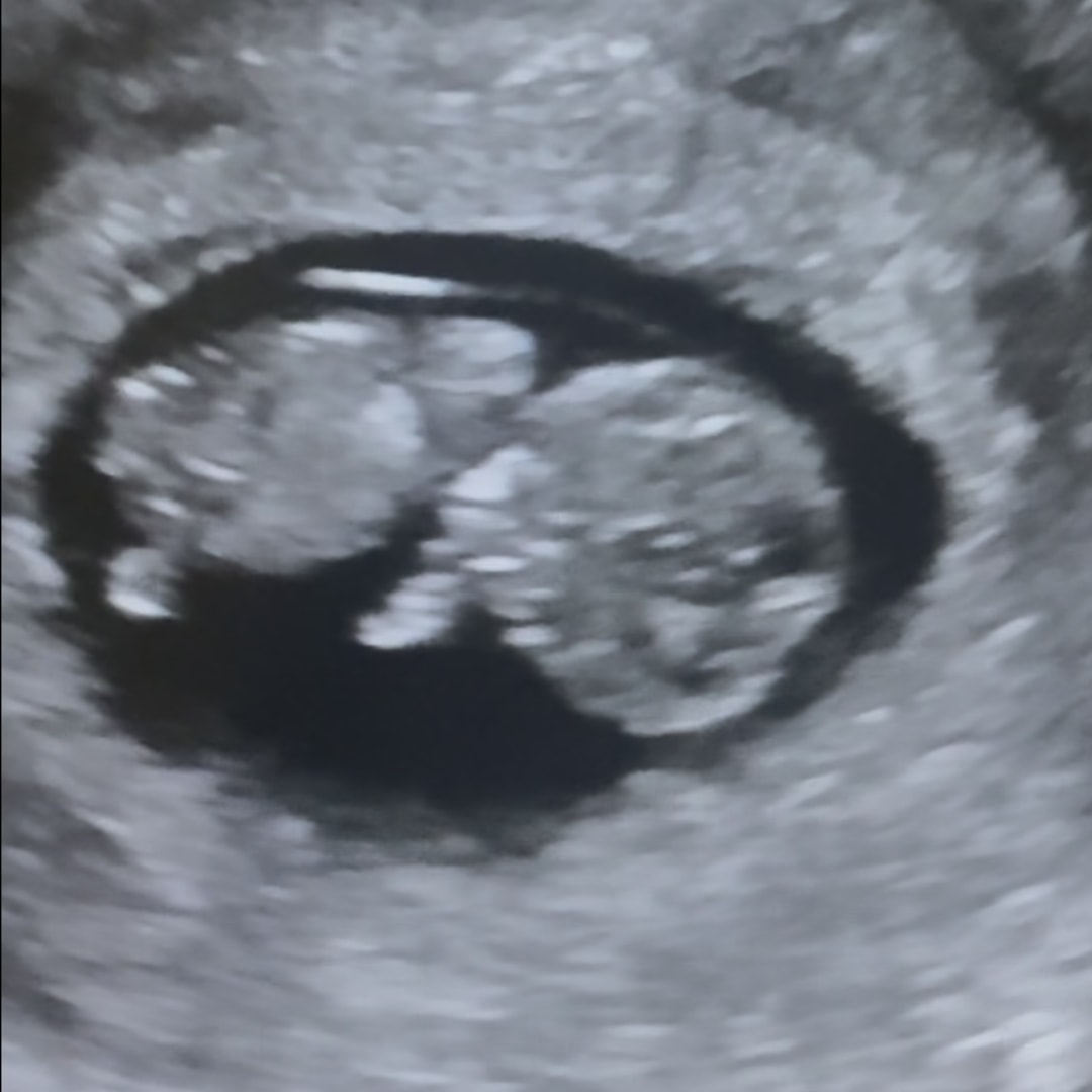 Photo shared by Ashley for their Babylist baby registry.