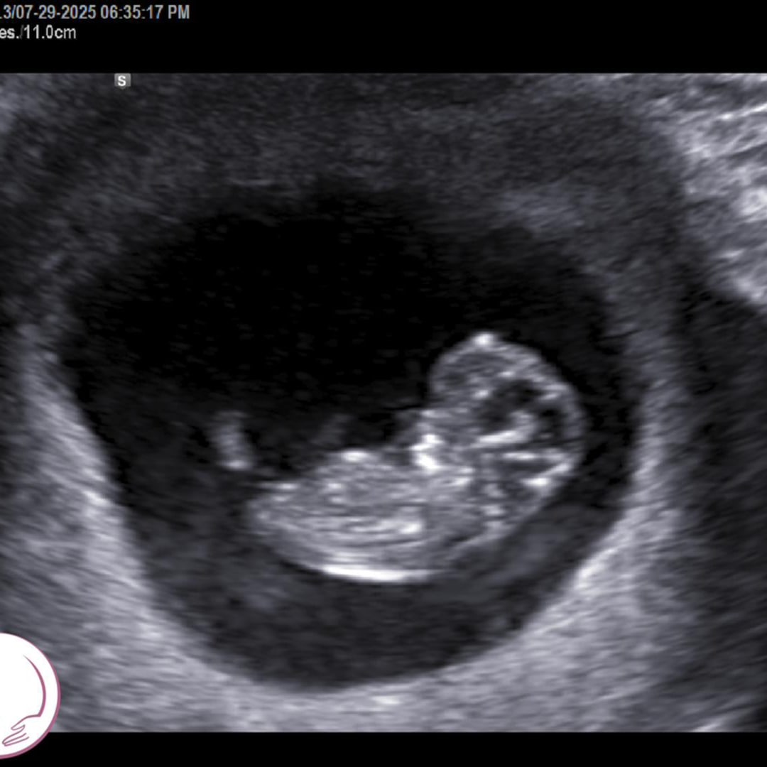 Photo shared by Audrey for their Babylist baby registry.