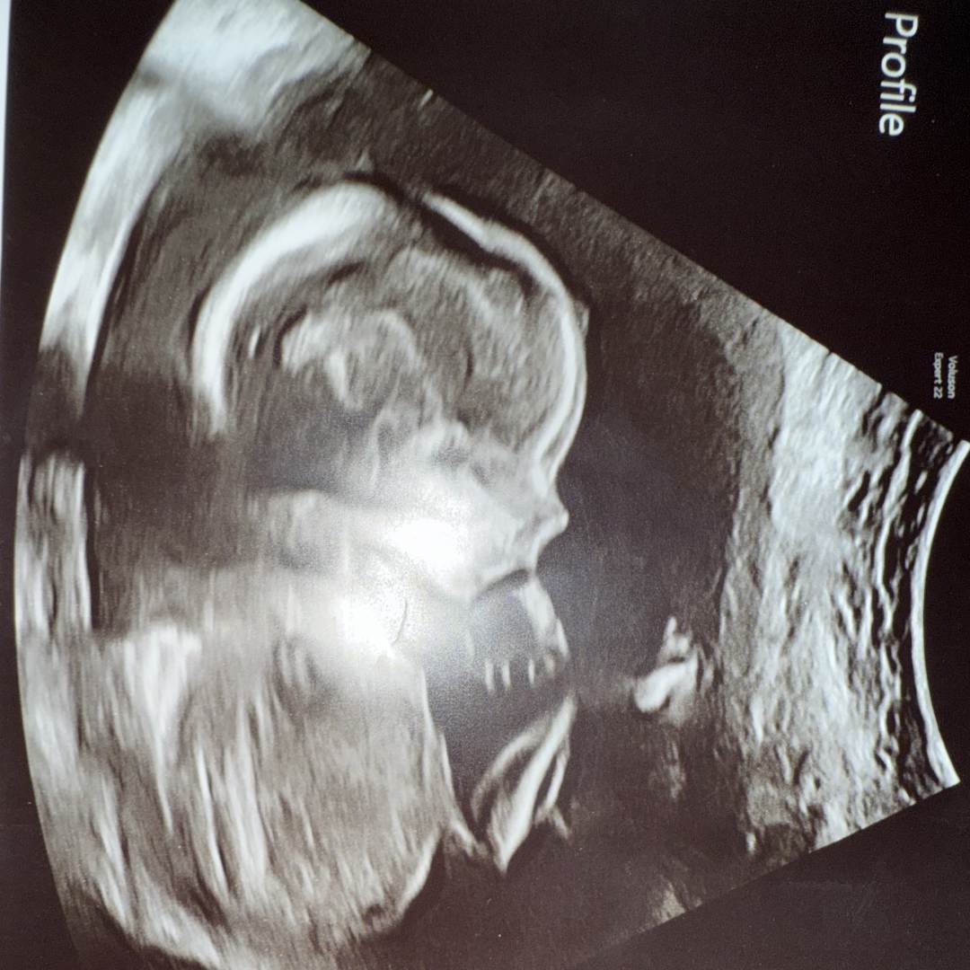 Photo shared by Holly for their Babylist baby registry.