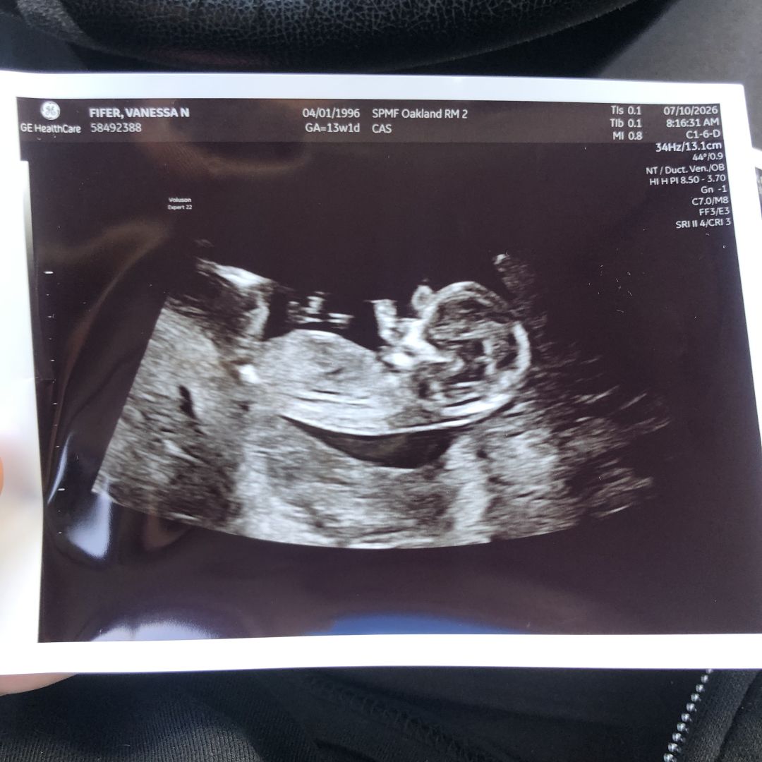 Photo shared by Vanessa for their Babylist baby registry.