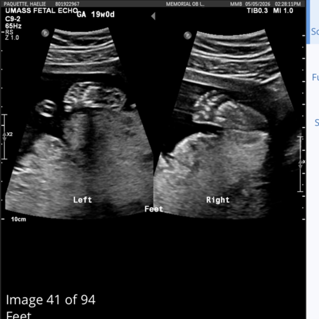 Photo shared by Haelie for their Babylist baby registry.