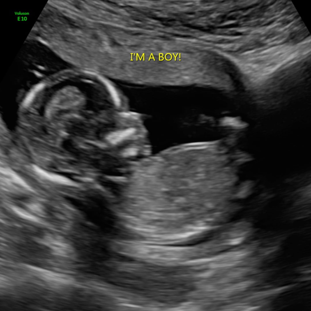 Photo shared by Alayna for their Babylist baby registry.