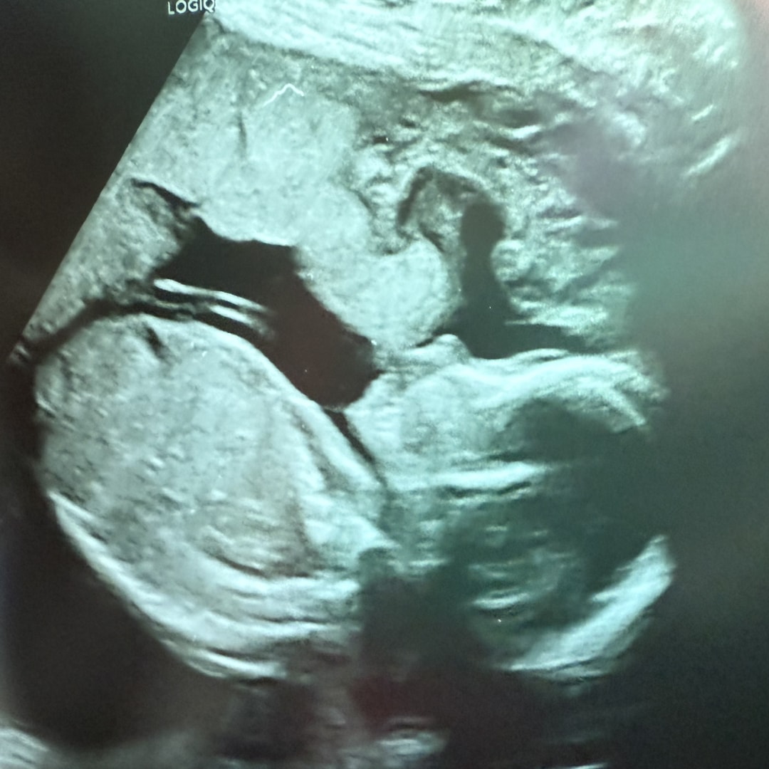 Photo shared by Gabriela for their Babylist baby registry.