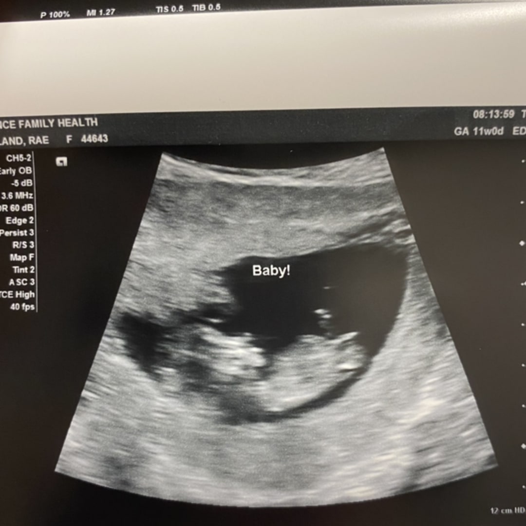 Photo shared by Rae for their Babylist baby registry.