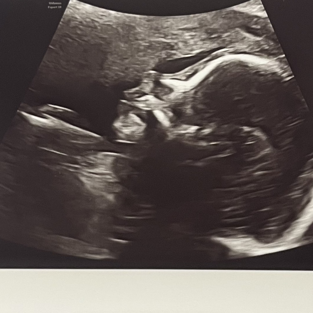 Photo shared by Jennifer for their Babylist baby registry.