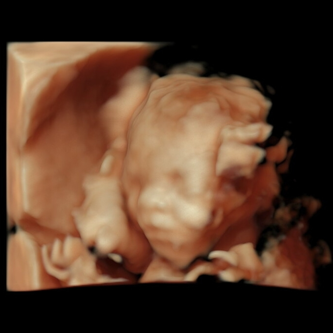 Photo shared by Jemima for their Babylist baby registry.