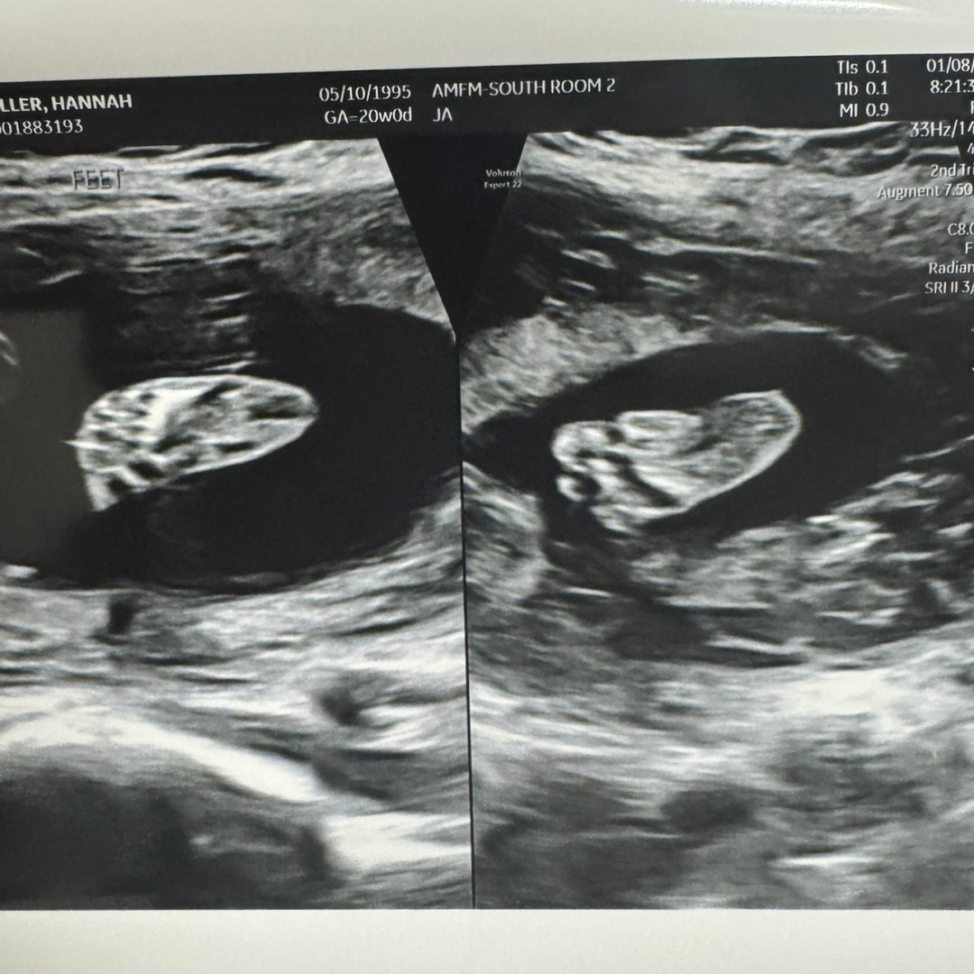 Photo shared by Hannah for their Babylist baby registry.