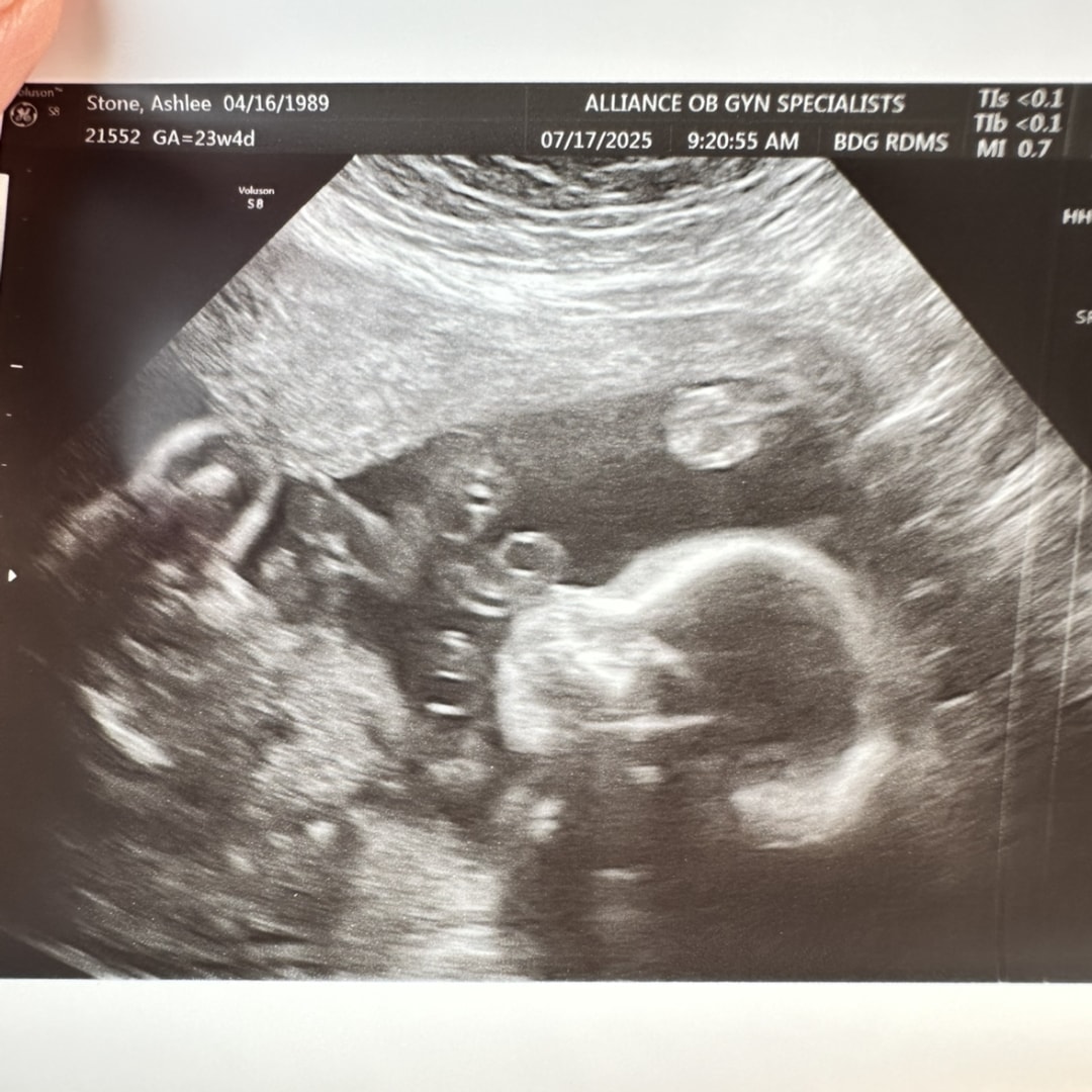 Photo shared by Ashlee for their Babylist baby registry.