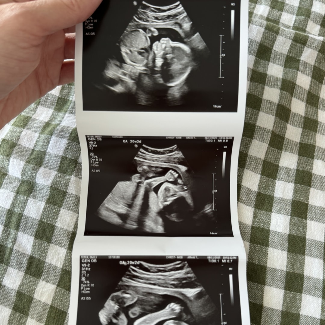 Photo shared by Emily for their Babylist baby registry.
