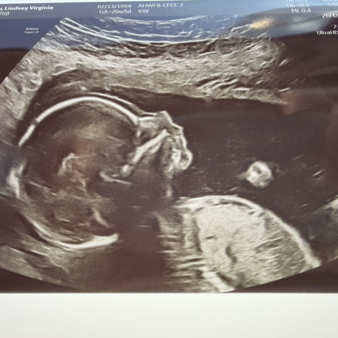Photo shared by Lindsey for their Babylist baby registry.