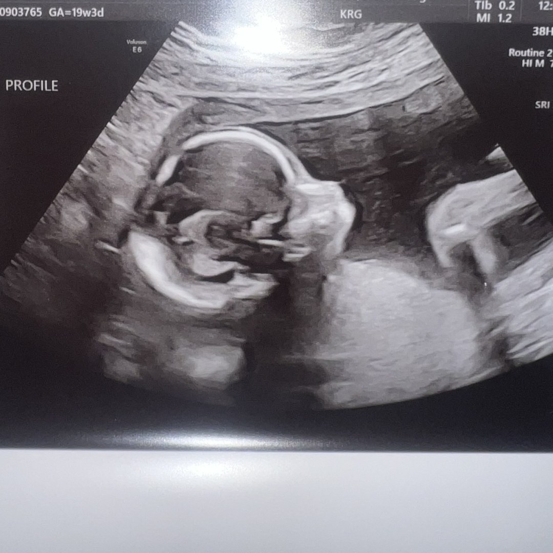 Photo shared by Lexi for their Babylist baby registry.