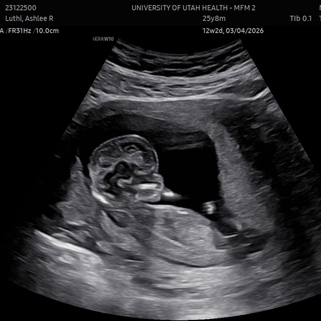 Photo shared by Ashlee for their Babylist baby registry.