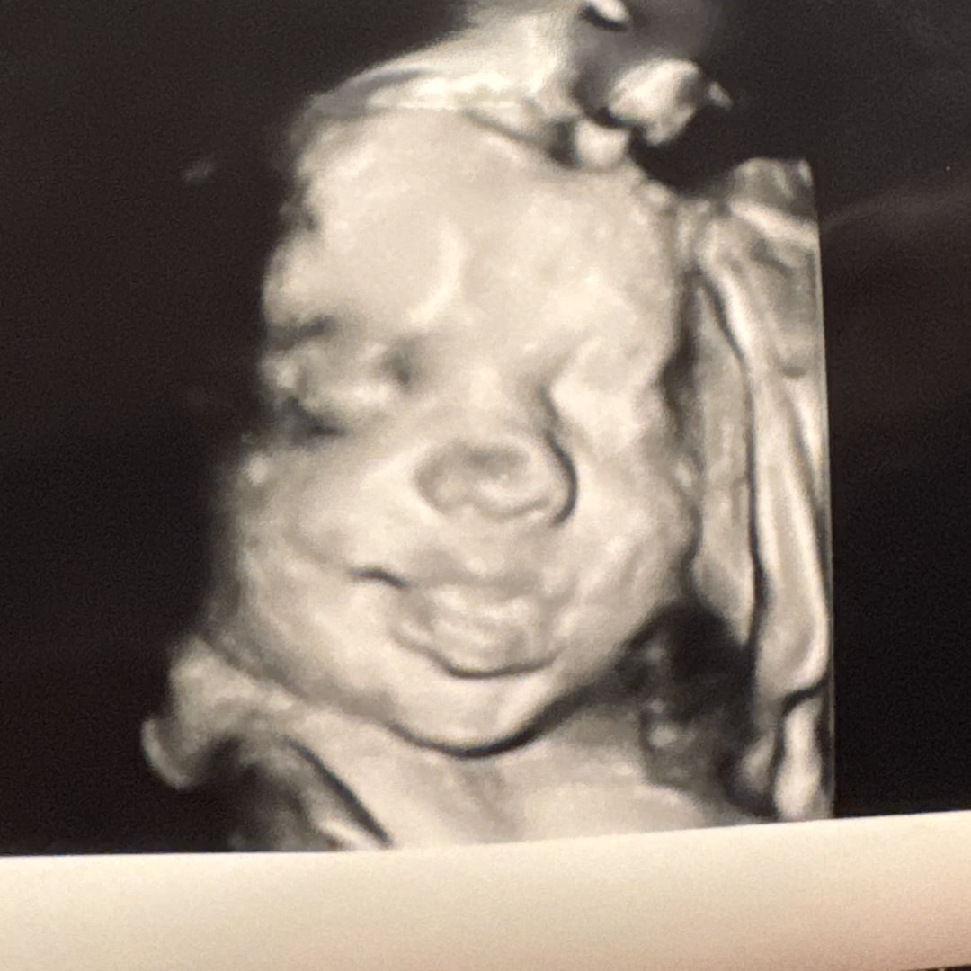 Photo shared by Maddie for their Babylist baby registry.