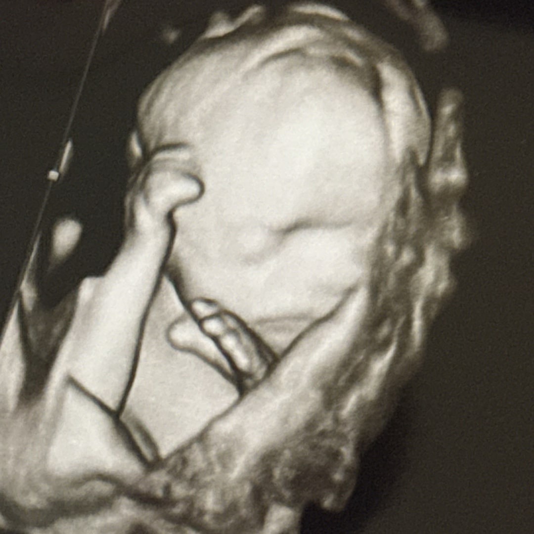 Photo shared by Michelle for their Babylist baby registry.