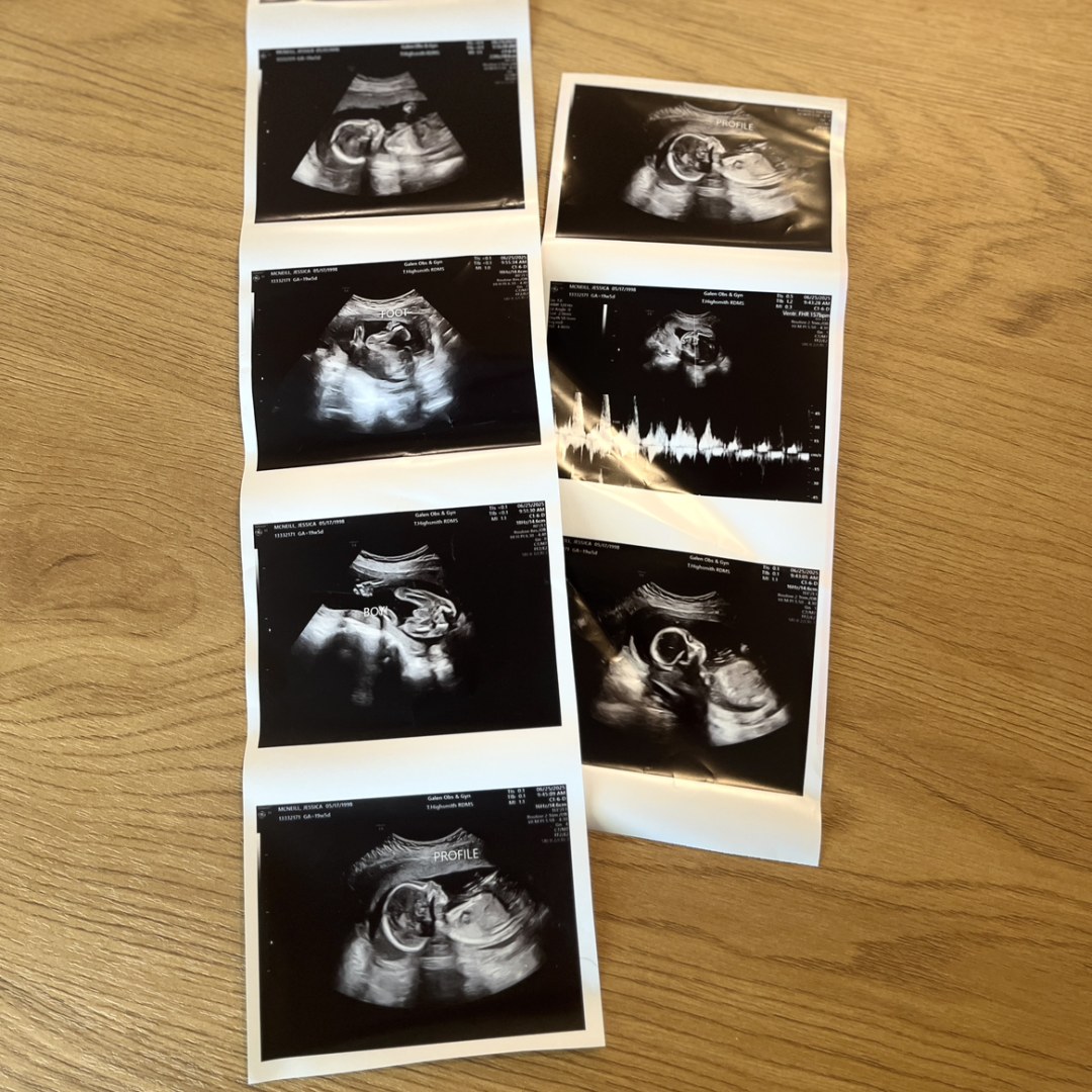 Photo shared by Jessica for their Babylist baby registry.