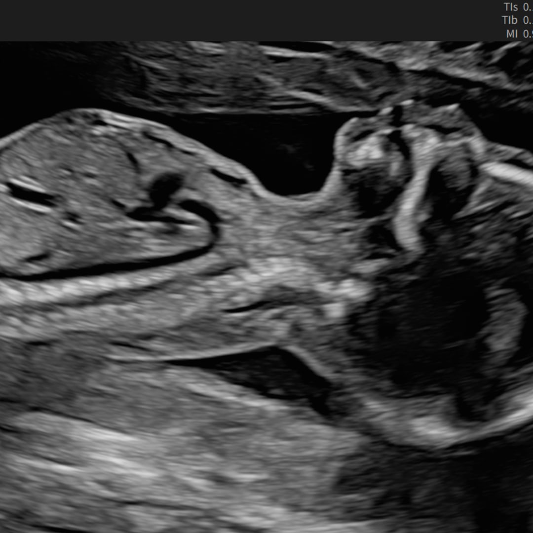 Photo shared by Keren for their Babylist baby registry.