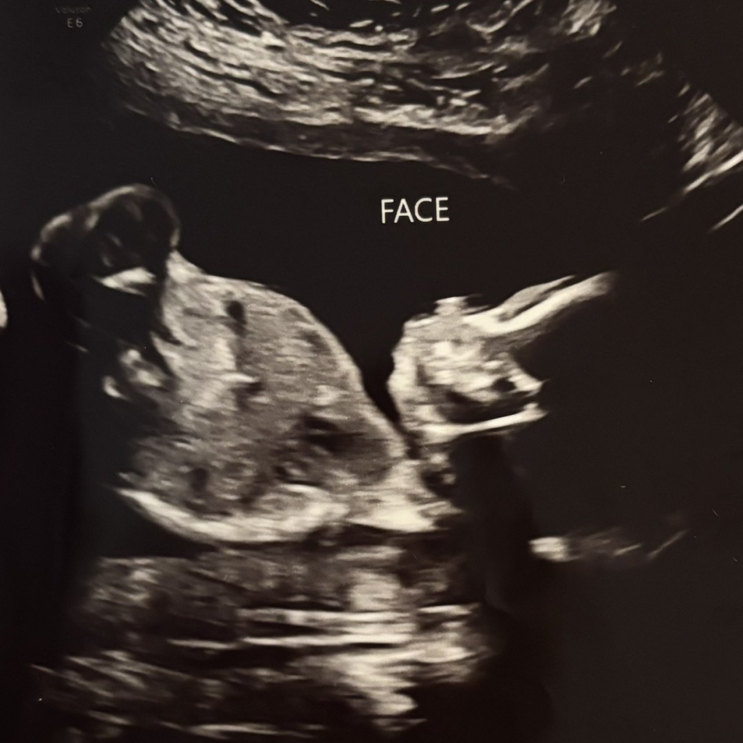 Photo shared by Taylor for their Babylist baby registry.