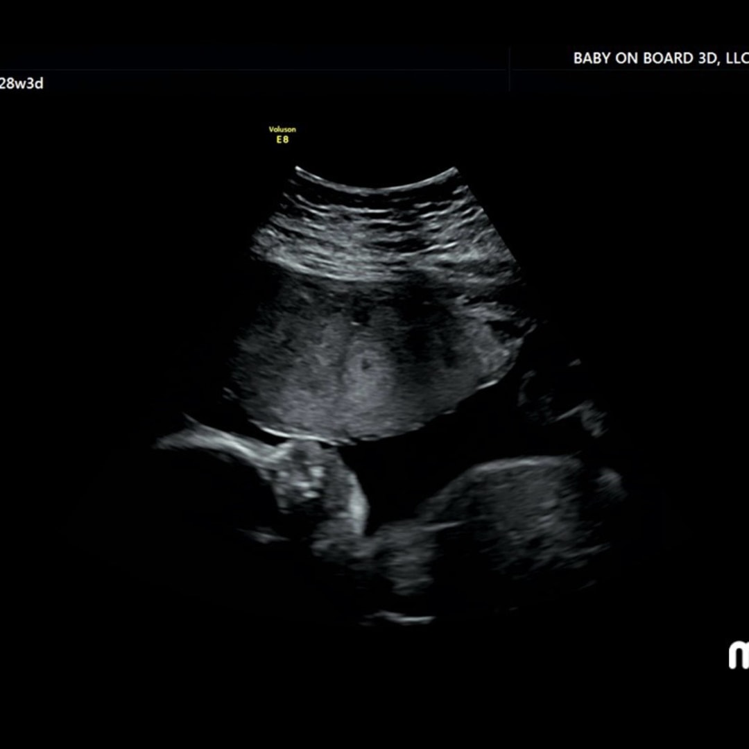 Photo shared by Jayda for their Babylist baby registry.