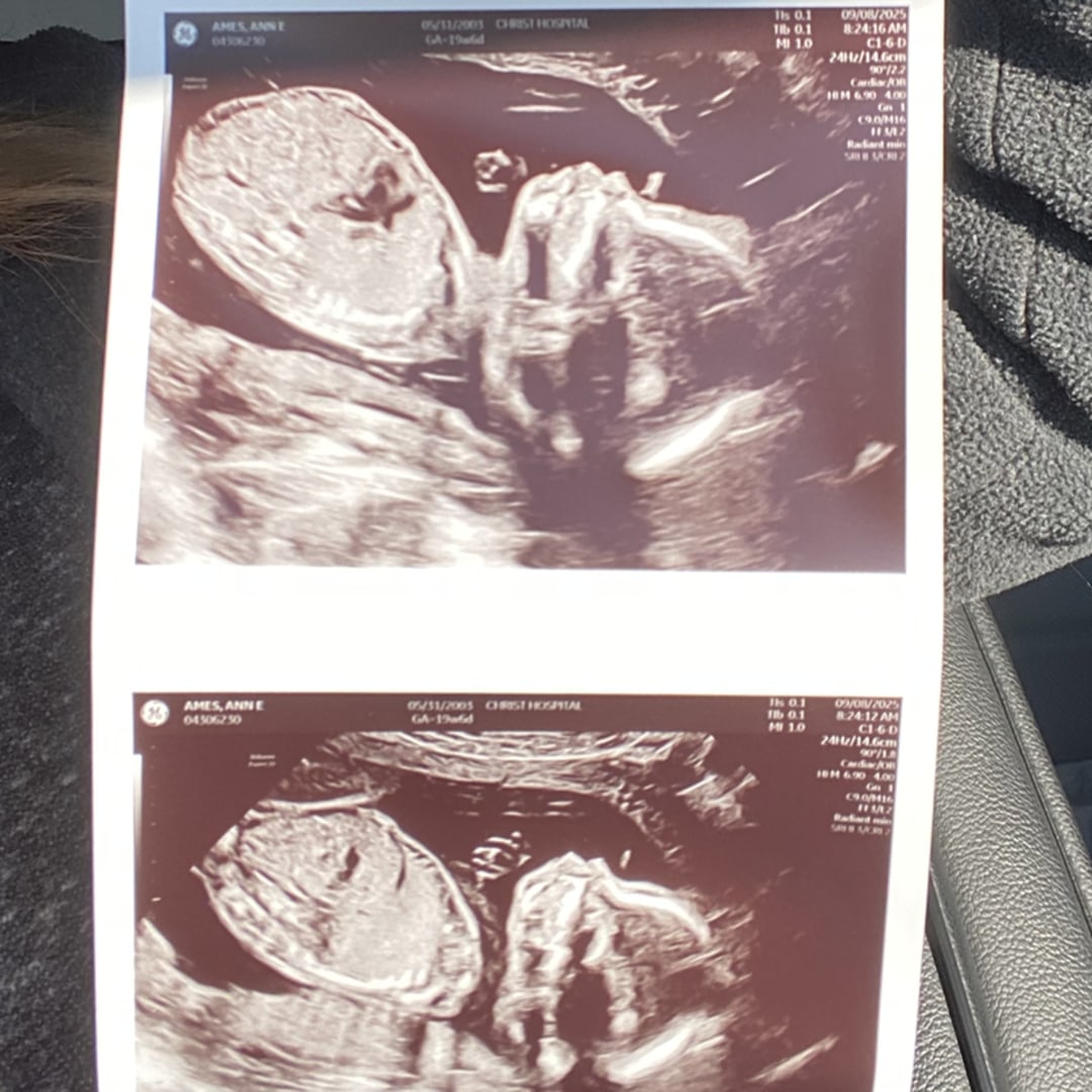Photo shared by Ann for their Babylist baby registry.